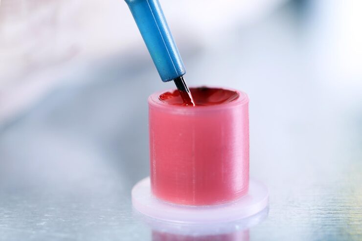Chorionic Villus Sampling (CVS)